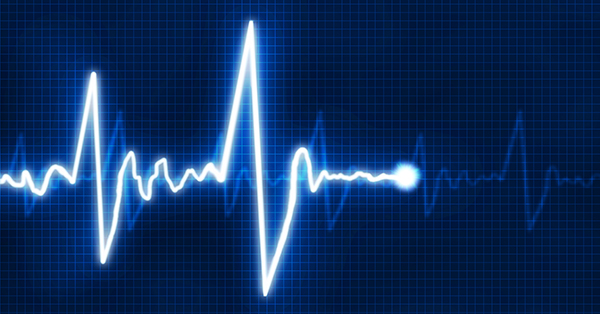 Έρευνα ΕΑΕΕ: Ελαφριά επιδείνωση της Αγοράς