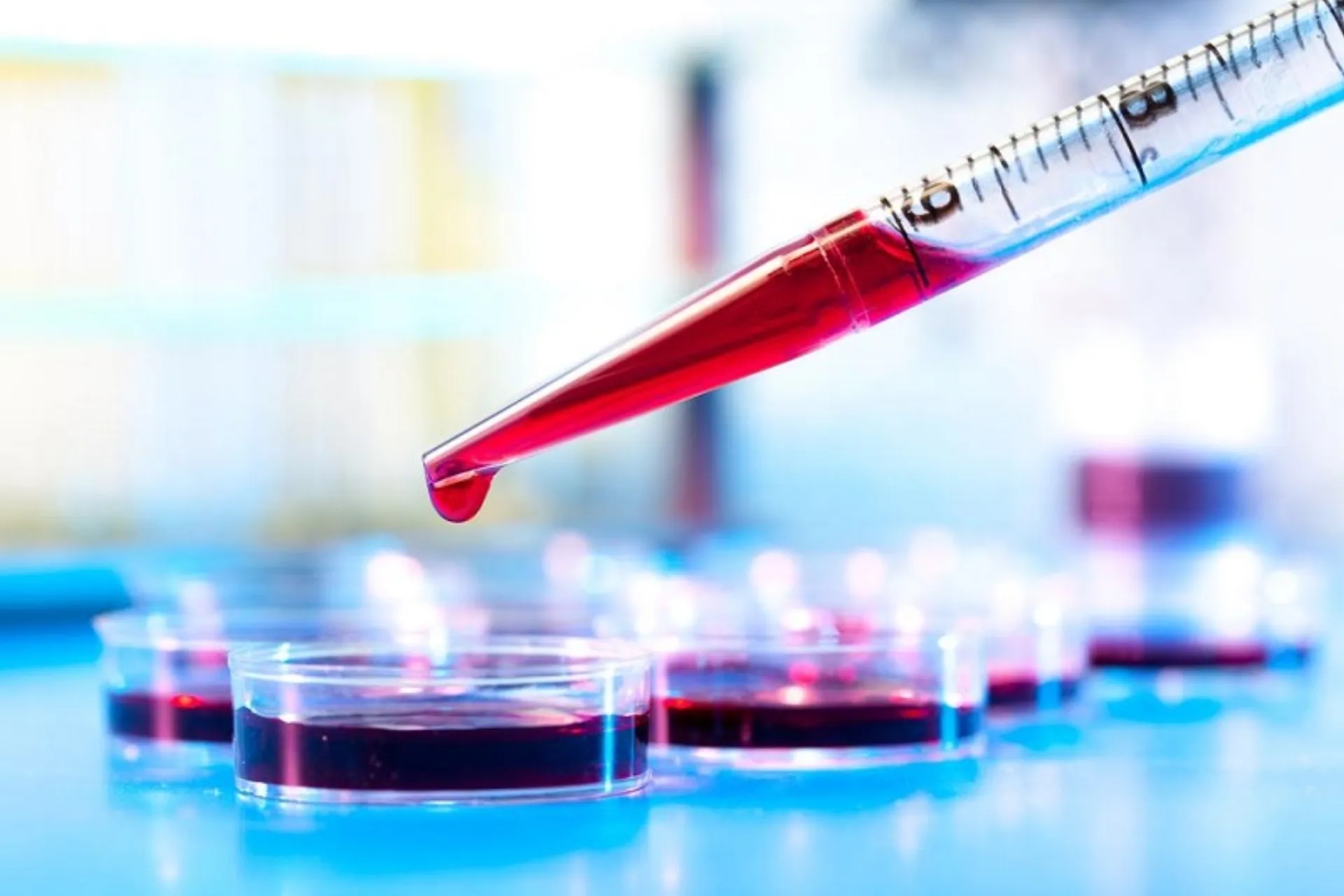 Άνοιξαν τα διαγνωστικά – Το 85% των εξετάσεων πληρώνουν οι ασφαλισμένοι του ΕΟΠΥΥ