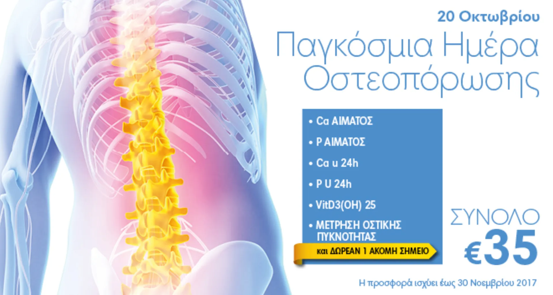 Affidea Ευρωιατρική: Πλήρης προληπτικός έλεγχος οστεοπόρωσης
