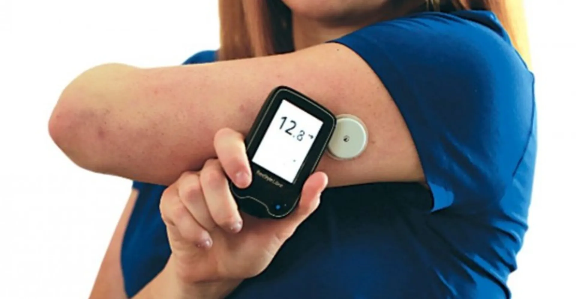 Στο “περίμενε” 14 μήνες για την αναίμακτη μέτρηση σακχάρου από τον ΕΟΠΥΥ