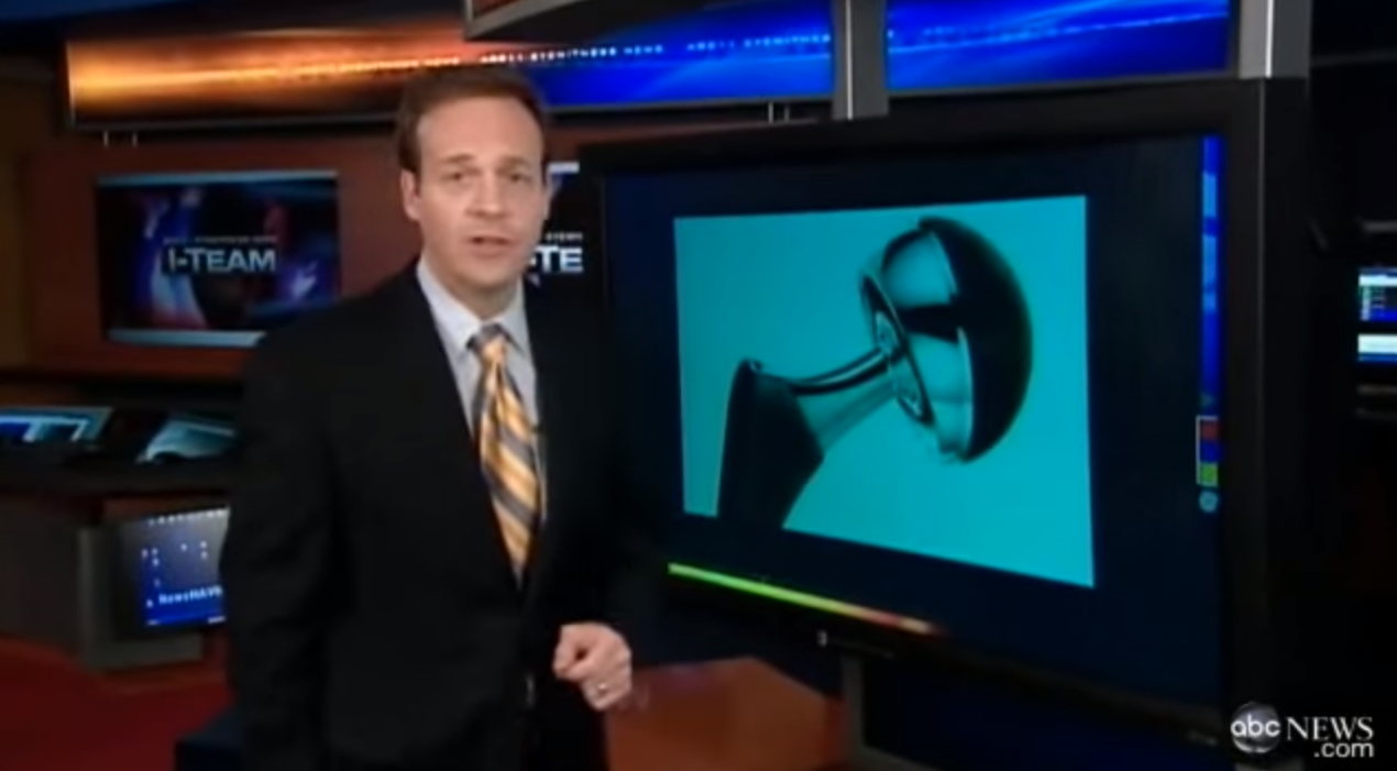 Διακανονισμός για 10.000 ασθενείς με ελαττωματικούς γοφούς από την Depuy της J&J