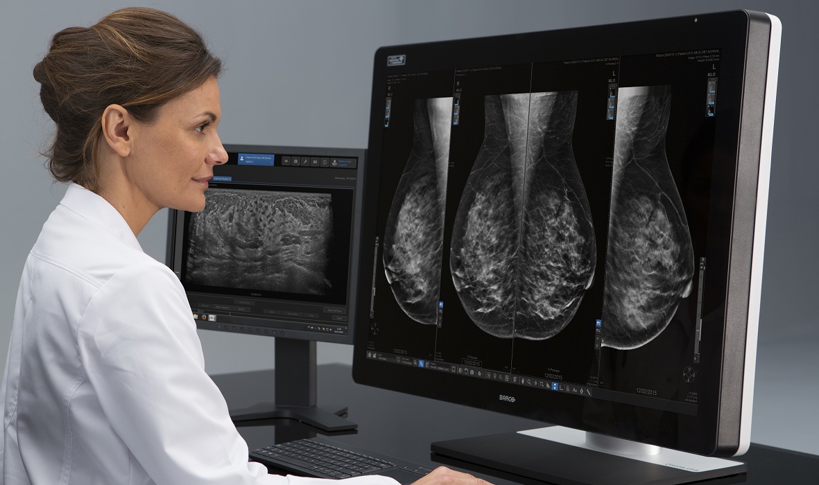 Affidea & ScreenPoint Medical: Διαγνωστική ακρίβεια σε μαστογραφίες με την χρήση της AI