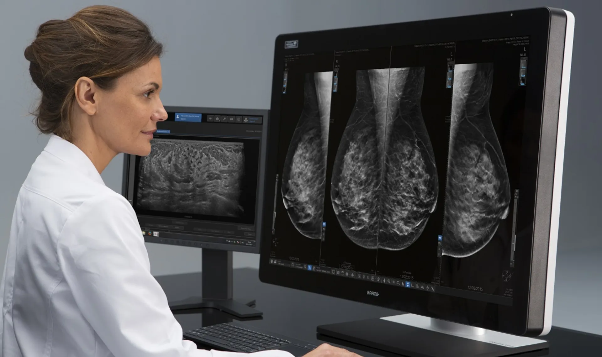 Affidea & ScreenPoint Medical: Διαγνωστική ακρίβεια σε μαστογραφίες με την χρήση της AI