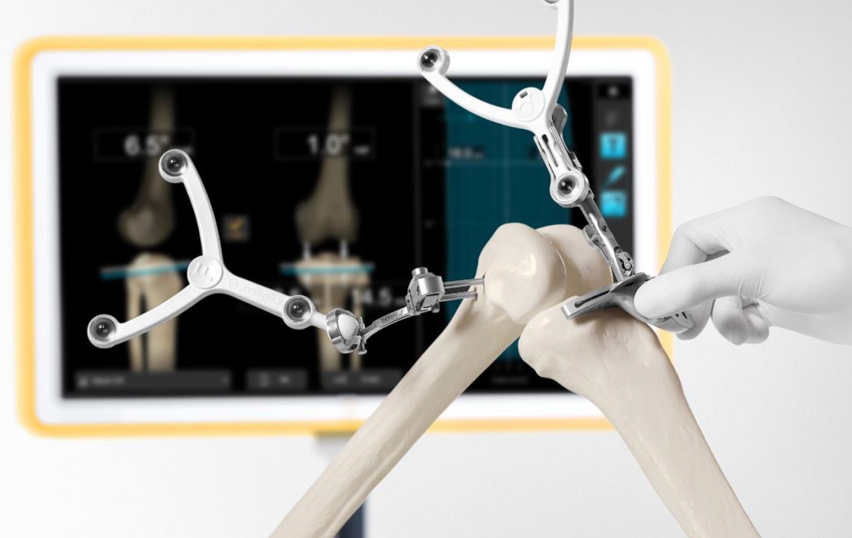 Ευρωκλινική: Πρωτοποριακό Σύστημα Ρομποτικής Πλοήγησης