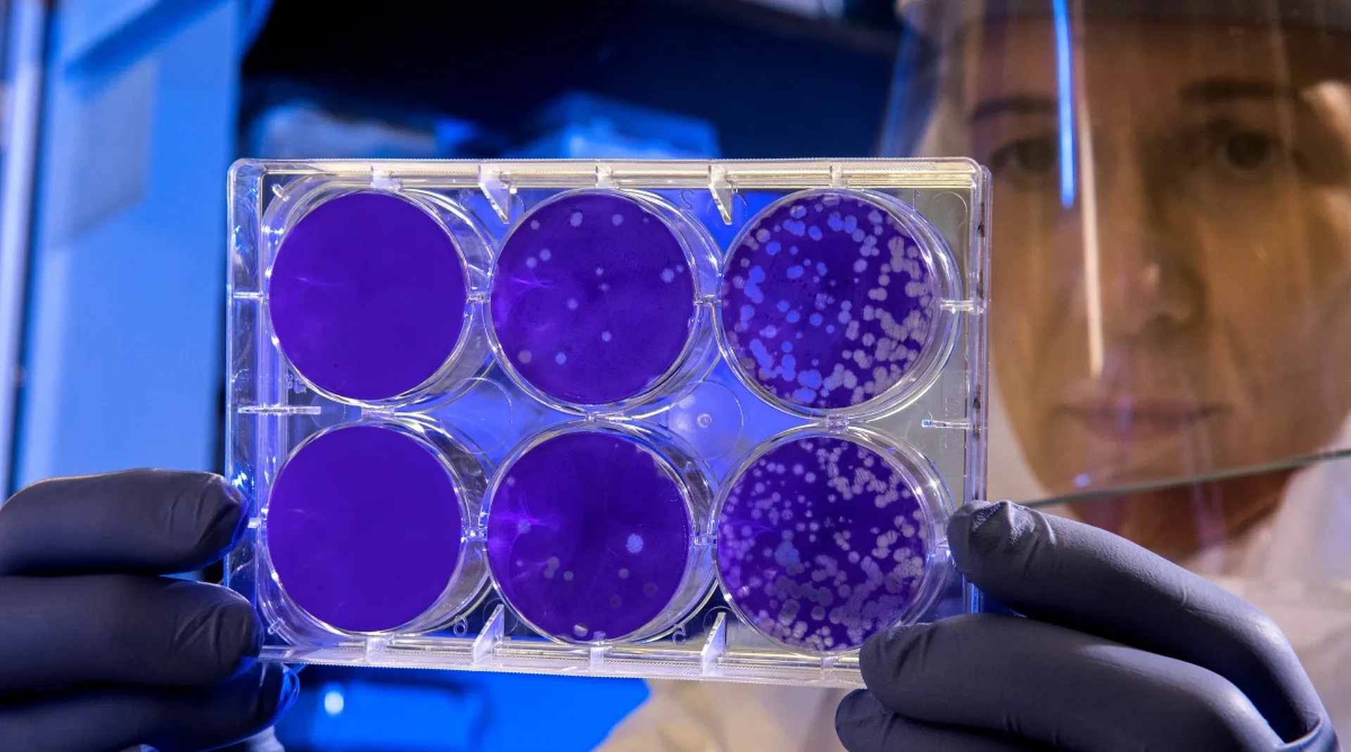 Εταιρεία ανέπτυξε τεστ-εξπρές που επιτρέπει την ανίχνευση του κορωνοϊού Covid-19 σε λιγότερο από δύο ώρες