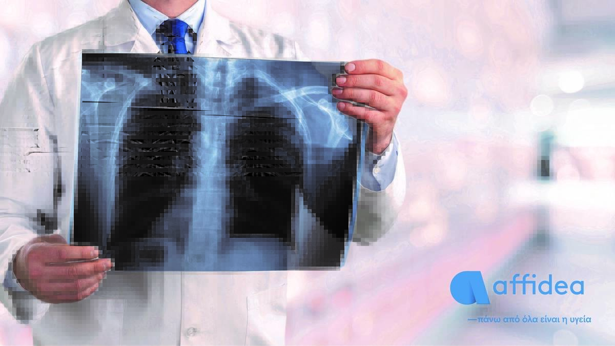 ΧΑΠ: Στην πρώτη πεντάδα των νοσημάτων με την μεγαλύτερη θνησιμότητα