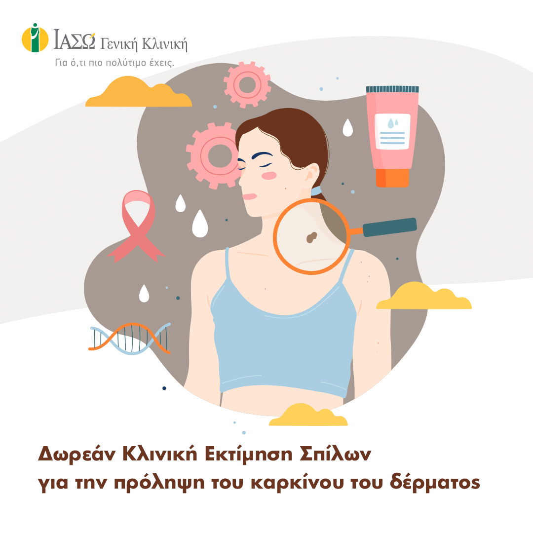 ΙΑΣΩ Γενική Κλινική: Δωρεάν Κλινική Εκτίμηση Σπίλων για την πρόληψη του καρκίνου του δέρματος